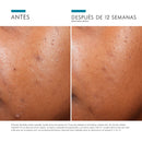 Skinceuticals Phyto A+ Brightening Treatment 30 ml