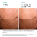 Skinceuticals Sérum Discoloration Defense 30 ml