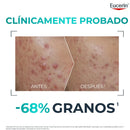 Eucerin Dermopure Probiom8 Rutina Probióticos Tópicos